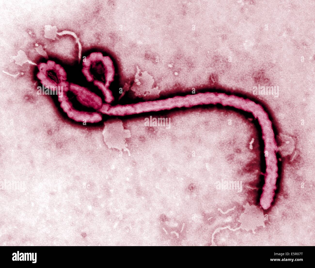 Ebola deaths hit 4,242, cases rise to 8,787 in DR Congo – WHO